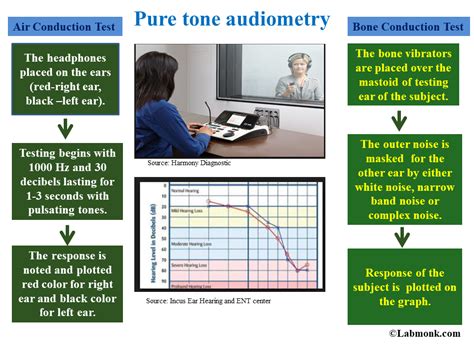 Pure Tone Audiometry in Primus 